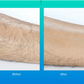 SilkSmooth Crystal Hair Eraser — Painless Hair Removal & Exfoliation