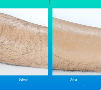 SilkSmooth Crystal Hair Eraser — Painless Hair Removal & Exfoliation